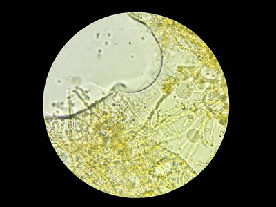 通过光显微镜获得的微型真菌图像对于任何purpro图片