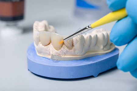 在牙科化验室内用人工凹陷和图片