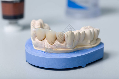 在牙科化验室内用人工凹陷和工具图片