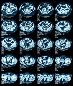 胸部和腹部磁共振图图片