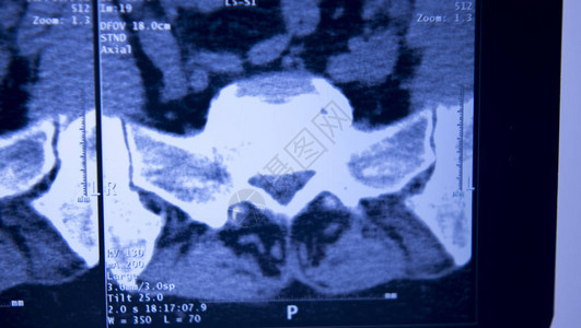 医院X射线胸骨脊椎骨盆MR图片