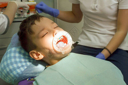 矫形医生把牙套绑在牙齿上男孩害图片
