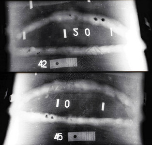 同一焊接的2个X射线框与大型炉渣内装物和不可接受尺寸的孔隙相同背景图片