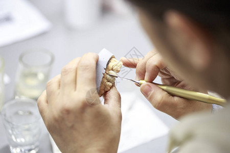 牙科技师正在做牙科铸件牙科技师的手与丙烯酸一起图片