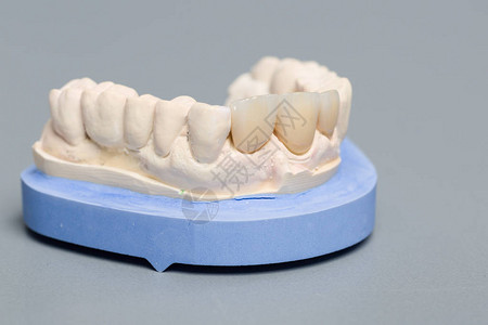 在牙科化验室的牙印上关闭了图片
