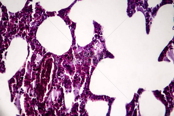 的组织病理学图片