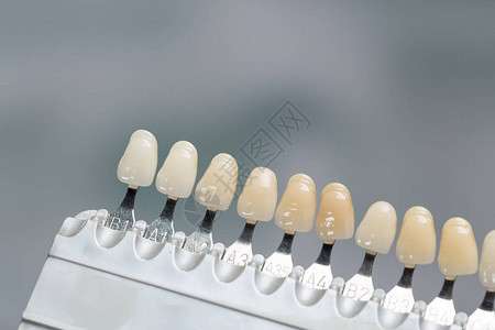 在牙科化验室检查牙冠外壳的阴图片