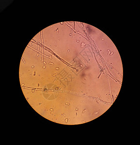 真菌细丝增加x40图片
