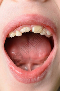 女人大嘴图片