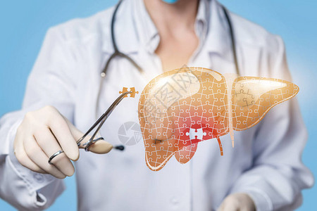 一位戴着手套和听诊器的医生正在用夹子将丢失的拼图放入带有炎症的患病肝脏模型中内脏治疗创图片