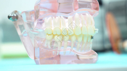 牙科诊所牙科护理和医学概念桌上的颌骨模型关闭牙医办图片