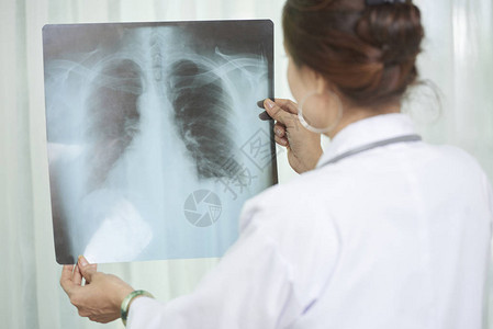 女肺部专家检查病人胸前图片