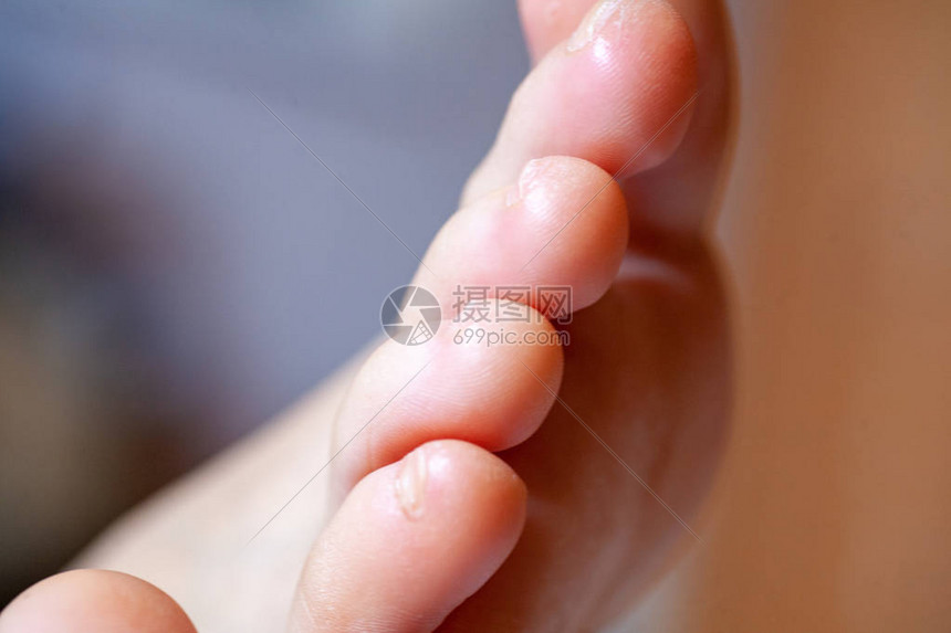 年轻女孩的脚趾健康美丽脚趾整齐医疗用品和药膏的概念脚趾和脚的形象带有铭文和广告空高清图片下载-正版图片506007506-摄图网