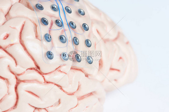 近距离观察用于脑波记录或人工大脑模型皮层电子脑摄影的次硬体图片