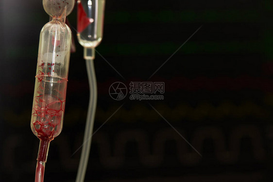 麻醉师在手术过程中输血后挂在手术室的血袋生命体征图片