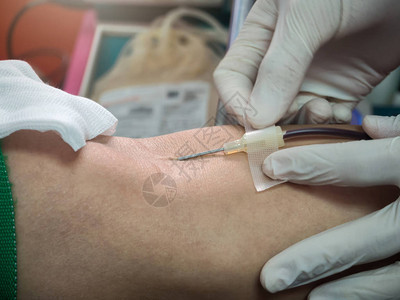 护士用医疗针刺伤捐血者手臂献血图片