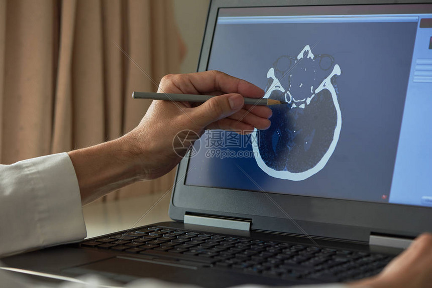 医生用铅笔演示人体大脑在医务室笔记本屏幕上进行自图片