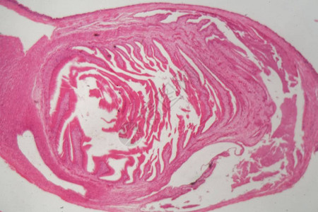 环流虫Echnoccocus的Hydatide细胞图片