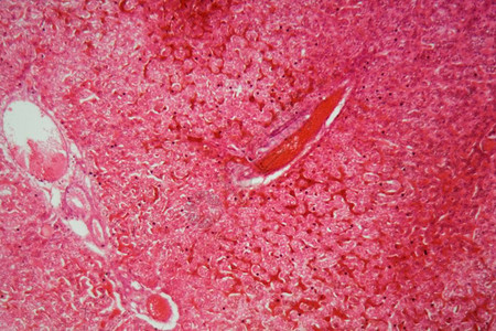 猪肝切片的显微镜照片图片素材