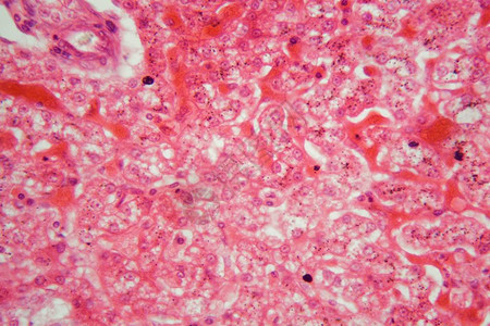 猪肝切片的显微镜照片图片素材