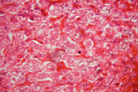 猪肝切片的显微镜照片图片素材