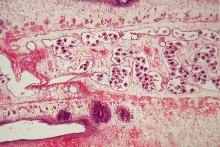 显微镜下的蠕虫体Proglott图片