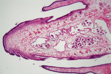 显微镜下的蠕虫体Proglott图片