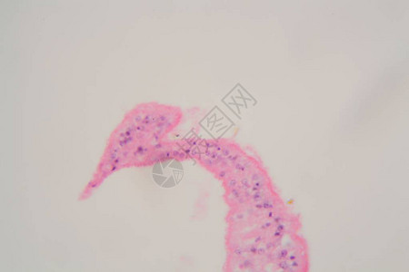 在显微镜下染色体瘤是人类寄生虫引起血图片