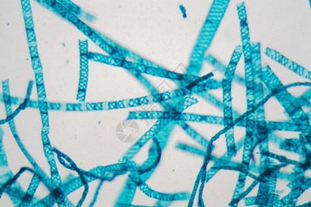 显微镜下的Spirogyra图片