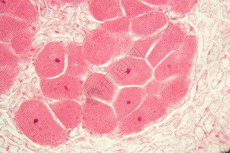 显微镜下豆根中的根细菌结节图片