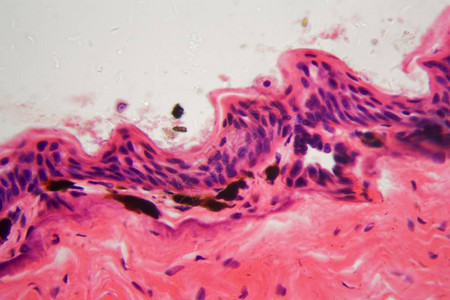 显微镜下两栖动物皮肤溃疡的细胞图片
