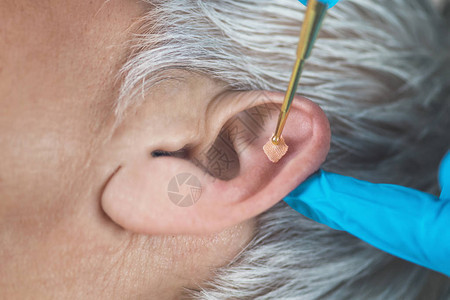 或用柔按摩黄铜耳笔对人耳进行耳膜治疗图片