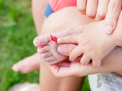 治疗孩子的伤口治疗小孩子的伤口孩子腿受伤图片