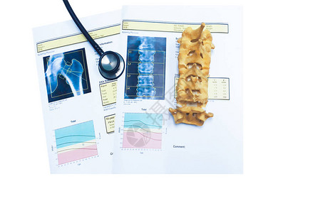 桌面背景上的顶部骨骼密度和脊椎结果骨质疏松图中含有过多的噪音胶片粒压图片