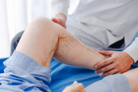 近距离拍摄的医生对一名手术后腿膝和腿部有瘀伤的病人进图片