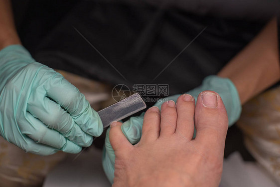 足病医生治疗脚趾甲足病治疗应用凝胶抛光去除甲剥离的Podology在医疗办公室与足科医生一起治疗图片
