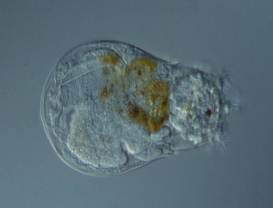 Parameciumcaudatum是显微镜下的单细胞纤毛原生动物和细菌属图片