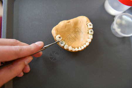牙齿布局和蛀牙假牙科培训班儿童和牙医牙科教图片