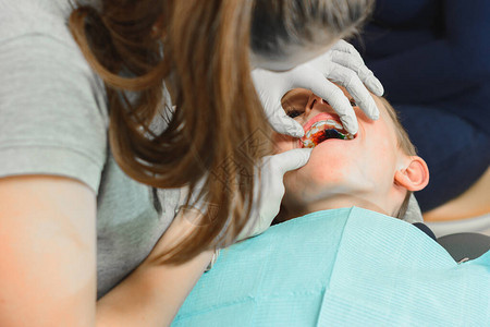 矫形医生检查了男孩的牙齿咬一口图片