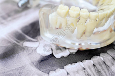 一个透明的人类下巴模型长着永久牙齿和奶牙在浅薄图片