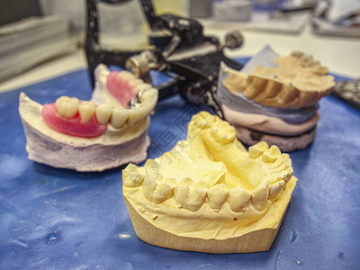 在石膏布局上植入陶瓷牙科植入器粉刷铸造表状人类下巴图片