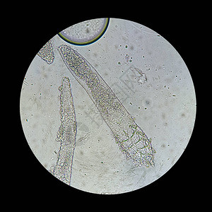 从显微镜视图中脱modexmite引起皮肤疾病的寄生虫Demod图片
