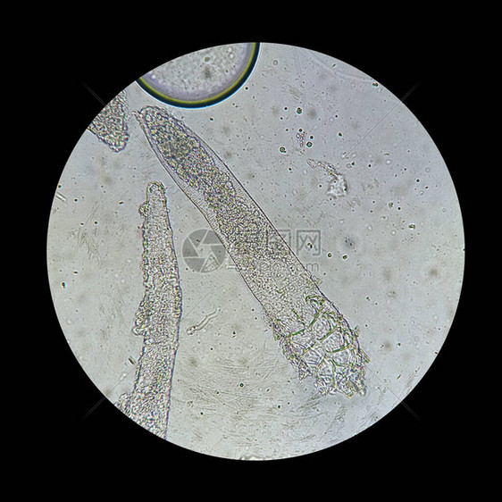 从显微镜视图中脱modexmite引起皮肤疾病的寄生虫Demod图片