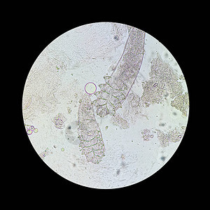 从显微镜视图中脱modexmite引起皮肤疾病的寄生虫Demod背景图片