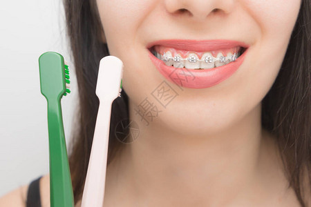 用刷子用牙套清洁牙齿美白后牙齿上有括号的幸福女人自锁式托槽图片