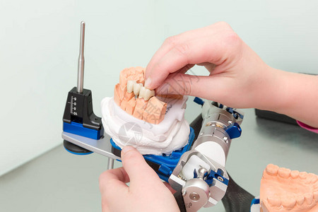 牙科实验室咬合架上人工牙列的工作特写图片