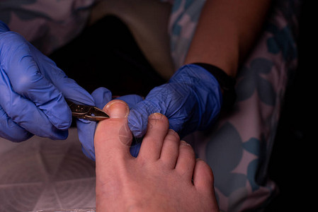 足病治疗足病医生医生去除老茧鸡眼并治疗向内生长的指甲硬件修指甲健康身体护理概念选择焦点足病学修脚没有凝胶图片