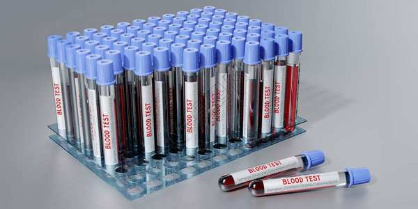 血液测试测试管图片