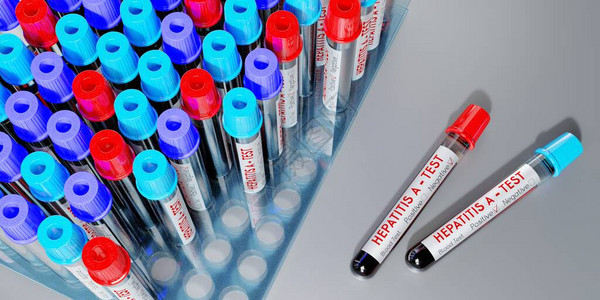 甲型肝炎测试管血液检测图片