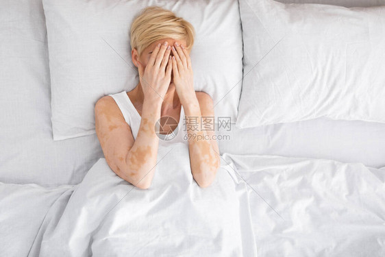 早上头疼得要命女人用手把脸藏起来躺在床上复制空图片